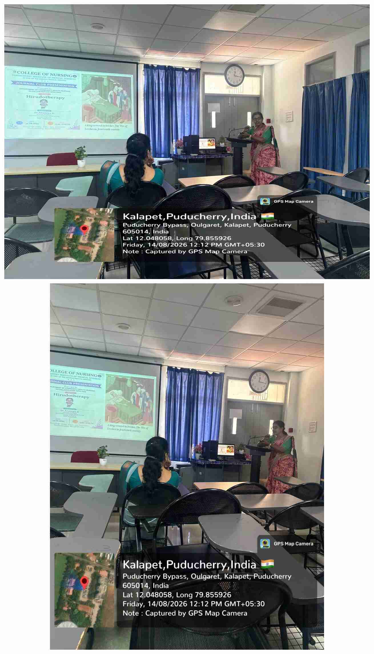 Journal Club Presentation on “Hirudotherapy